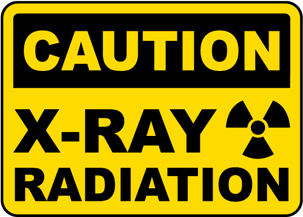 What Is An Example Of Radiation In Everyday Life