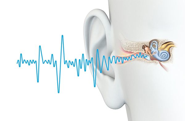 diffraction of sound in everyday life