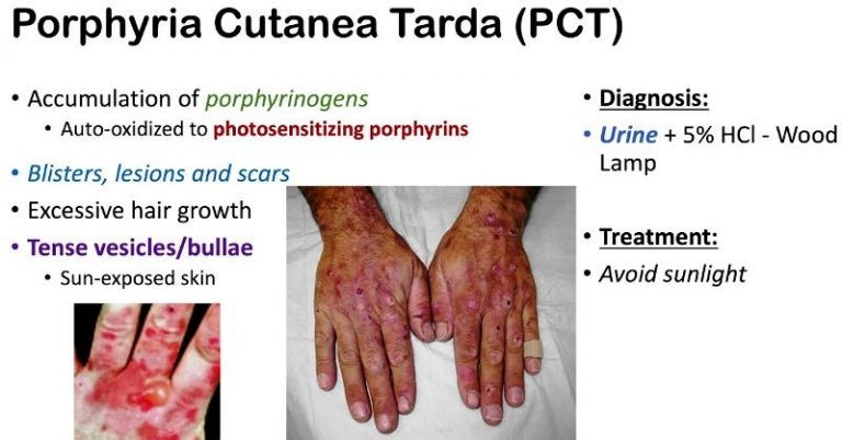 Hydroxychloroquine: Formula, Uses, Side Effects – StudiousGuy