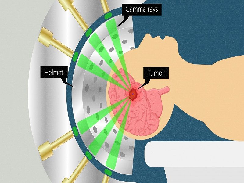 gamma radiation example