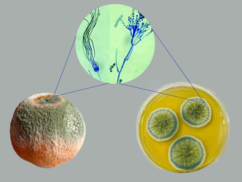 penicillium notatum microscope